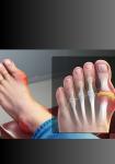 webstory image 1