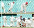 10 critical injuries on the cricket field