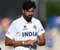 Ishant gets stitches on his right hand