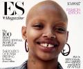 Meet Slick Woods, the model who is redefining beauty with a crooked smile