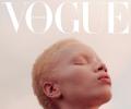 How this model with albinism created history