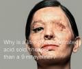 How an acid attack survivor walked into the world's heart!