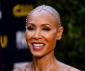 Understanding Jada Pinkett's hair loss condition