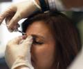 How Allergan plans to boost Botox sales in Indian market