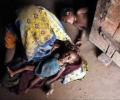 One-fifth of under-five deaths worldwide occur in India: UN