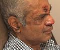 Indian left bleeding in hate crime in New Jersey