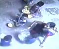 Telangana: Three minors at childcare centre 'burnt' with hot spoons as punishment