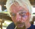 'Thought I was going to die': Richard Branson on horrific bike crash