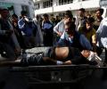 80 dead, 231 injured in Kabul suicide attack