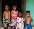 Modi must worry about India's malnutrition crisis