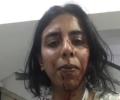 NGO members thrashed by locals while catching stray dogs in Delhi