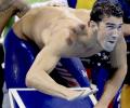 Here's why Phelps has those big red circles all over his back