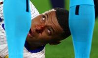 PIX: Mbappe breaks nose after collision at Euros