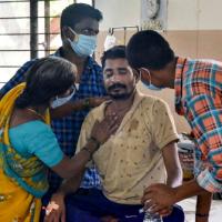 A Black Fungus infected patient in Hyderabad