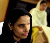 'In Pakistan, a woman's face is her greatest asset'