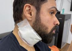 Emraan Gets Injured While Shooting