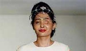 The acid attack survivor who walked the ramp in New York