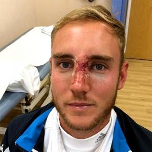 England name injured Broad in squad for fifth India Test