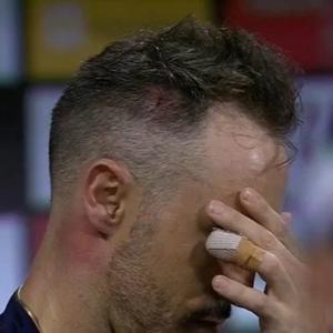 Have concussion with memory loss but recovering: Faf
