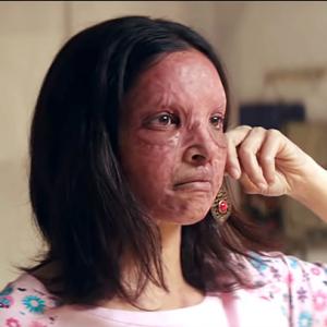 Chhapaak Trailer: Deepika's screams are spine-chilling