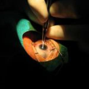 15 lose vision after free cataract surgery in Bihar