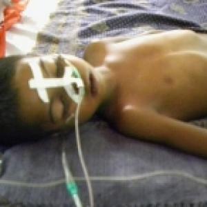 Killer encephalitis targets poor children in Bihar