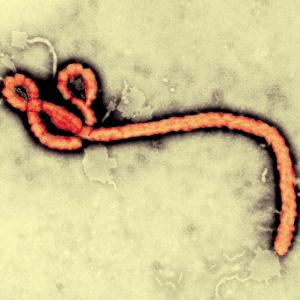 Here's what you MUST know about the deadly Ebola virus