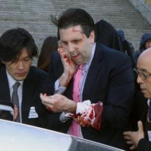US envoy to South Korea wounded in knife attack