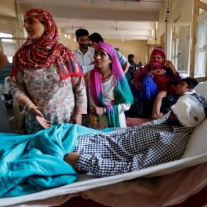 After the violence, Kashmir turns dark: 107 eye injuries and counting