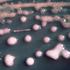 What we must know about SUPERBUGS