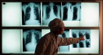 India could be 'efficacy test' for TB drug okayed by US