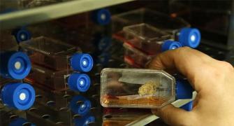 Secret behind the success of India's stem cell firms