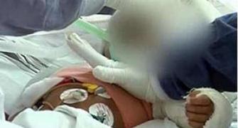 Battered baby Falak dies after battling odds for 2 months
