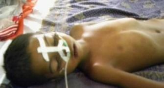 UP: 15 more kids die of encephalitis, toll reaches 271