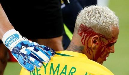 Neymar left bloodied in Brazil's thumping win; Argentina held