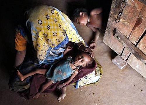 Rinku, 20 months, who weighs 4 kg and suffers from severe malnutrition, lies in his mother's lap in Naingarh village of Sheopur district in Madhya Pradesh.