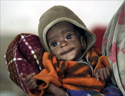 Four-month-old Vishakha, who weighs 2.3 kg (5 lbs) and suffers from severe malnutrition, is carried at the Nutritional Rehabilitation Centre of Shivpuri district in Madhya Pradesh.