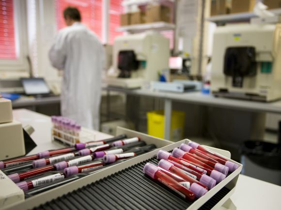 Blood samples are pictured at a laboratory for Doping Analysis 