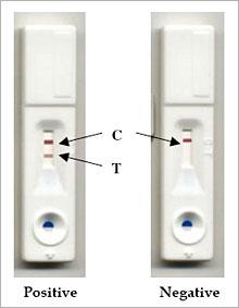 sequential testing pregnancy vs quad screen