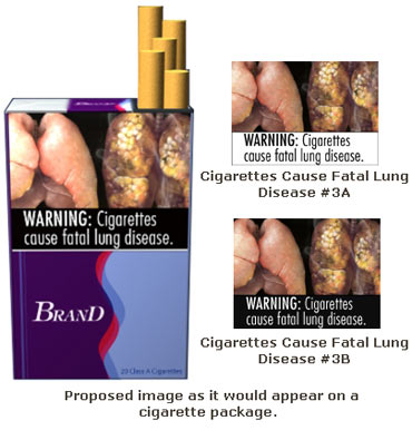 Cigarettes cause fatal lung disease