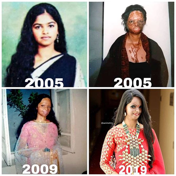 Laxmi Agarwal's journey after the attack