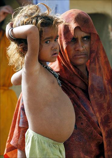 Four-year-old Kiran, who is suffering from malnutrition, stands next to her mother Sheil Rani in Balabehat village.