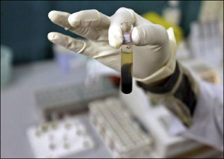 A laboratory assistant examines a sample inside a laboratory in Siliguri.