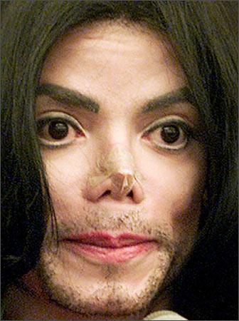 michael jackson nose before and after