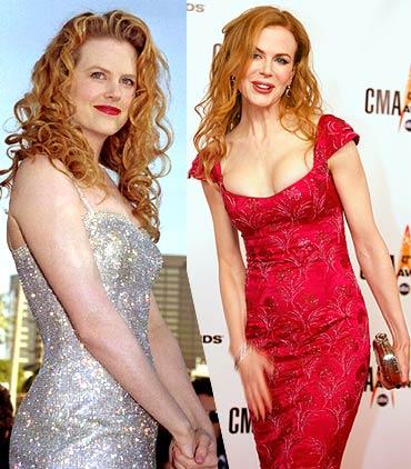 Nicole Kidman