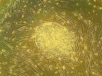 Human embryonic stem cells