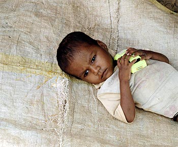 A two-year-old child suffering from grade-four malnutrition rests outside his hut in Kelghar village, about 150 km northeast from Mumbai