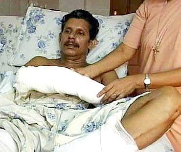 Professor T J Joseph in hospital after the brutal attack