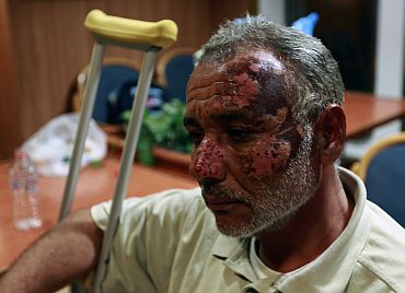 A Libyan ambulance driver wounded in Misrata, arrives in the port of Benghazi onboard the Greek ferry Ionian Spirit