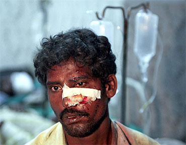 An injured passenger receives treatment at a hospital after a train collision in Chennai